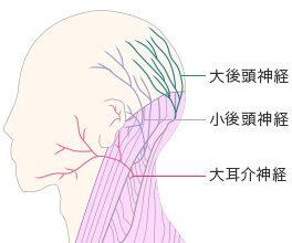 後頭神経痛の体操に関するよくある質問